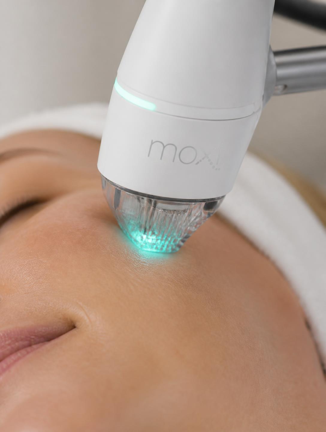 Tecnologia estetica medica avanzata con luce laser su pelle